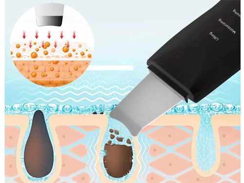 VG-01694 - Ultrahangos kavitációs peeling, fekete