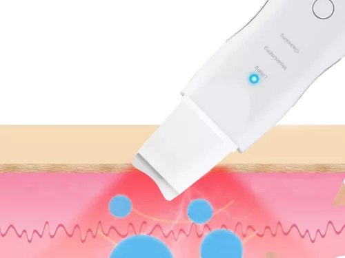 VG 01806 ultrahangos kavitációs peeling, fehér
